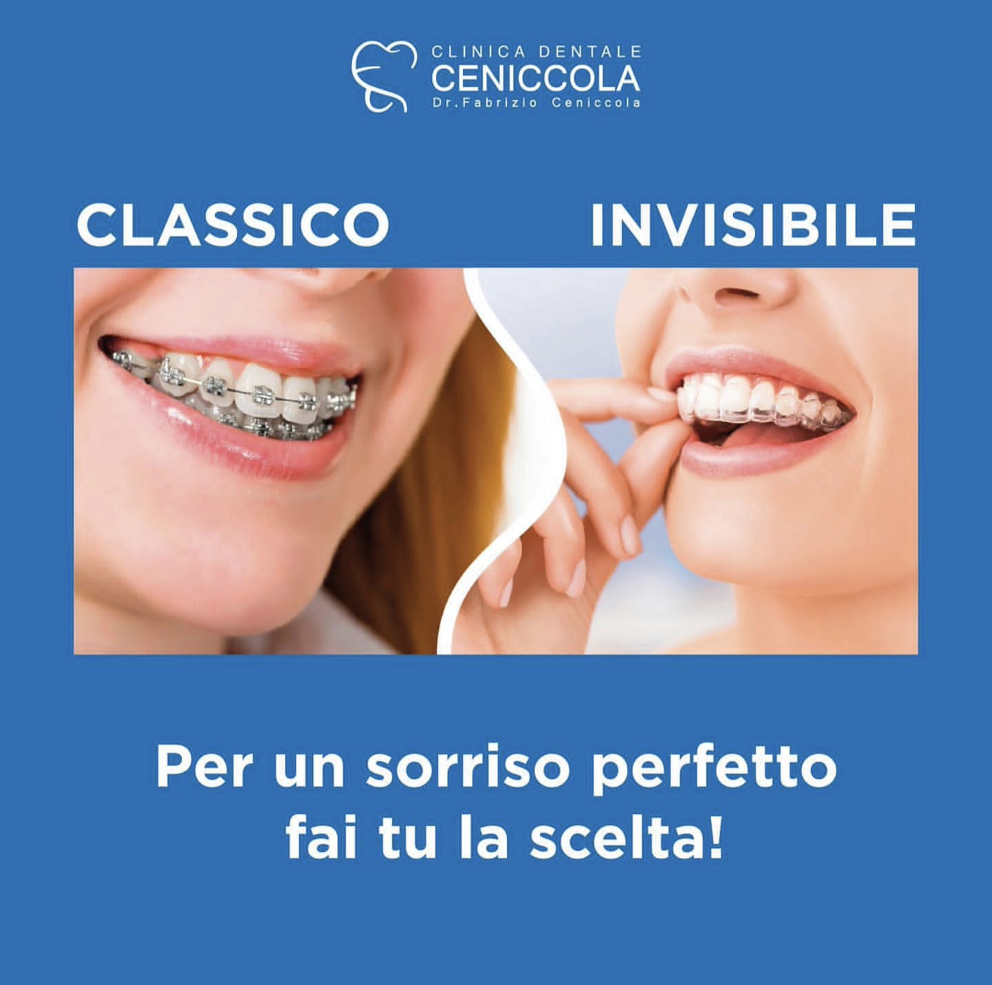 Ortodonzia classica e invisibile